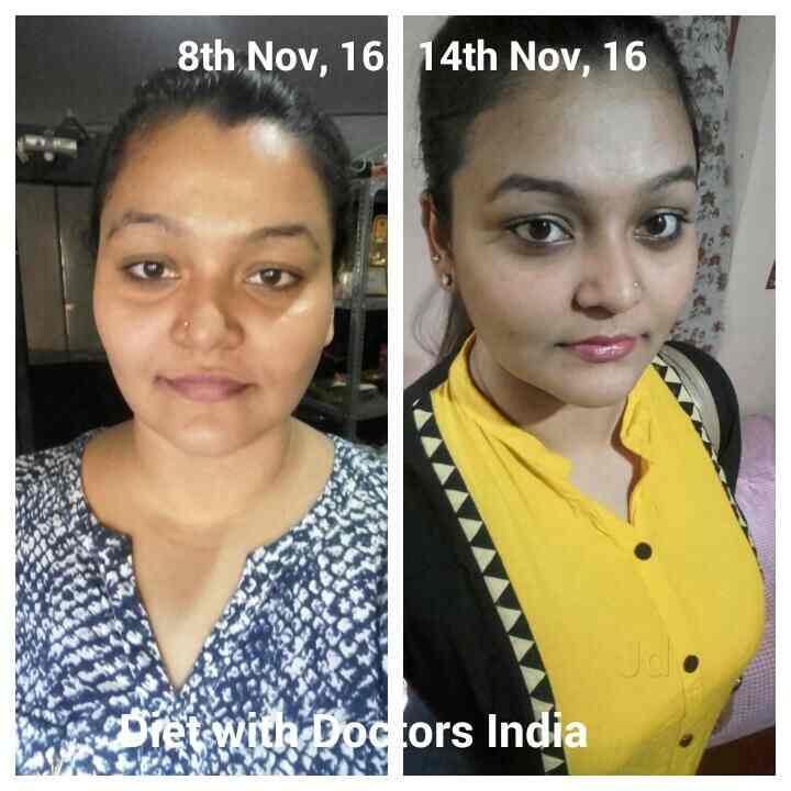 Medshape weight loss peoria picture 2